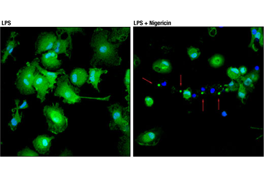 Immunofluorescence Image 1: ASC/TMS1 (D2W8U) Rabbit mAb (Alexa Fluor<sup>®</sup> 488 Conjugate)