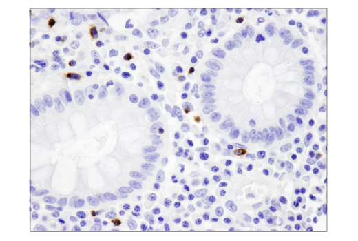 Immunohistochemistry Image 2: LAG3 (D2G4O) Rabbit Monoclonal Antibody (BSA and Azide Free)