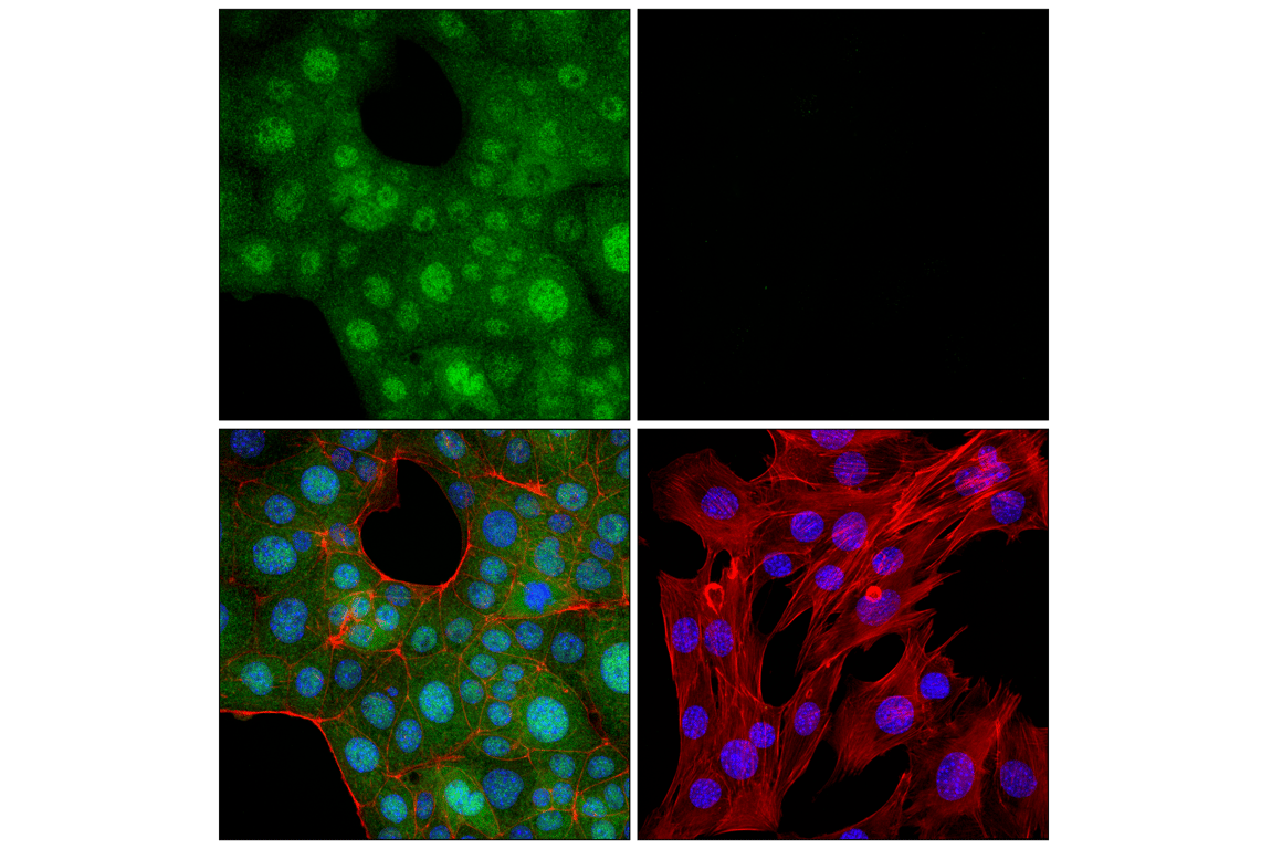 Immunofluorescence Image 1: p16 INK4A (F2T7H) Rabbit Monoclonal Antibody