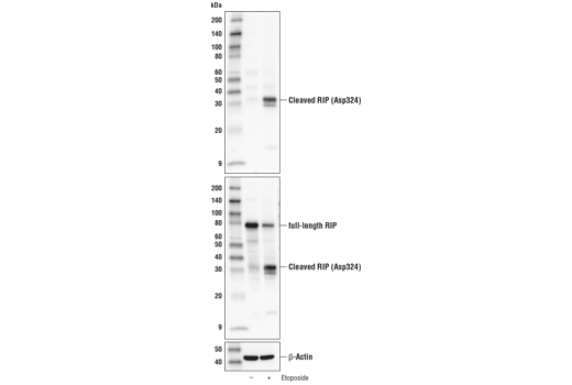 Western Blotting Image 2: Cleaved RIP (Asp324) (D5P6D) Rabbit Monoclonal Antibody