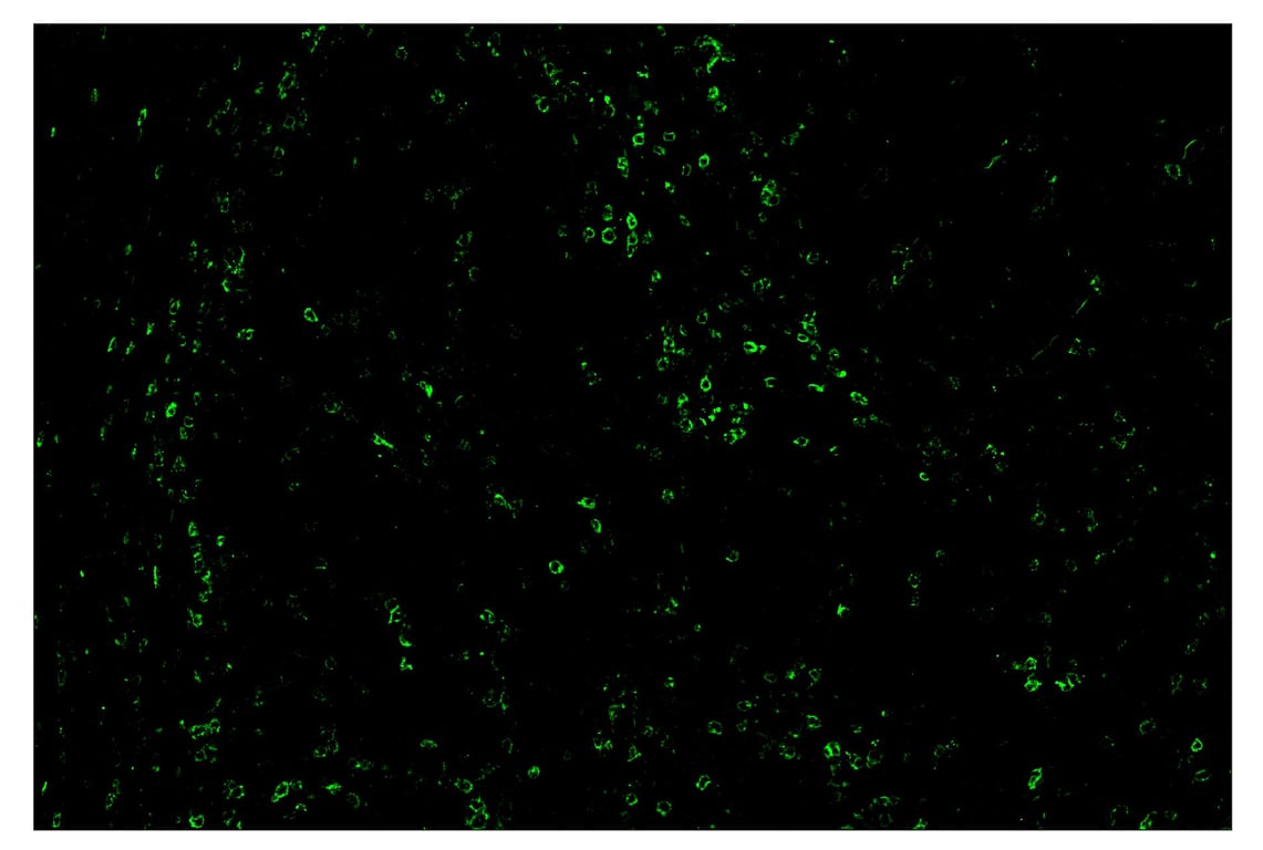 Immunohistochemistry Image 2: PD-1 (Intracellular Domain) (D4W2J) & CO-0008-488 SignalStar<sup>™</sup> Oligo-Antibody Pair