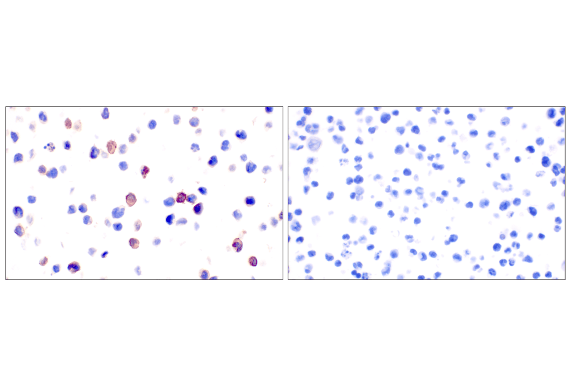 Immunohistochemistry Image 9: GLIPR2 (F7H7V) Rabbit Monoclonal Antibody