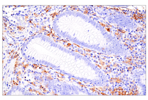Immunohistochemistry Image 7: FcR gamma (E6Y1A) Rabbit Monoclonal Antibody