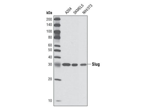 Western Blotting Image 1: Slug (C19G7) Rabbit mAb (BSA and Azide Free)