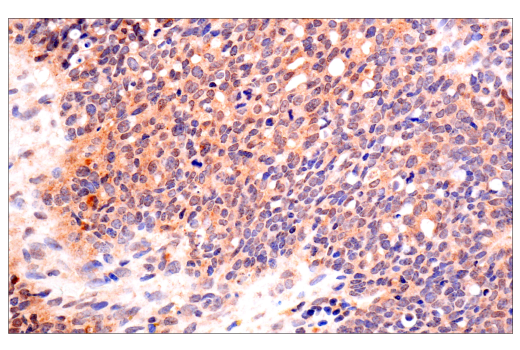 Immunohistochemistry Image 4: VHL (E3X9K) Rabbit Monoclonal Antibody (BSA and Azide Free)