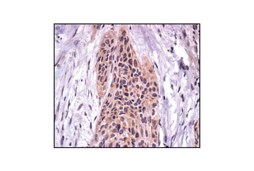 undefined Image 9: Focal Adhesion Protein Antibody Sampler Kit