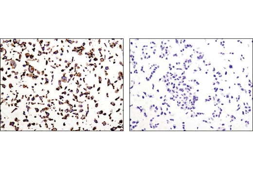 undefined Image 47: Epithelial-Mesenchymal Transition (EMT) Antibody Sampler Kit
