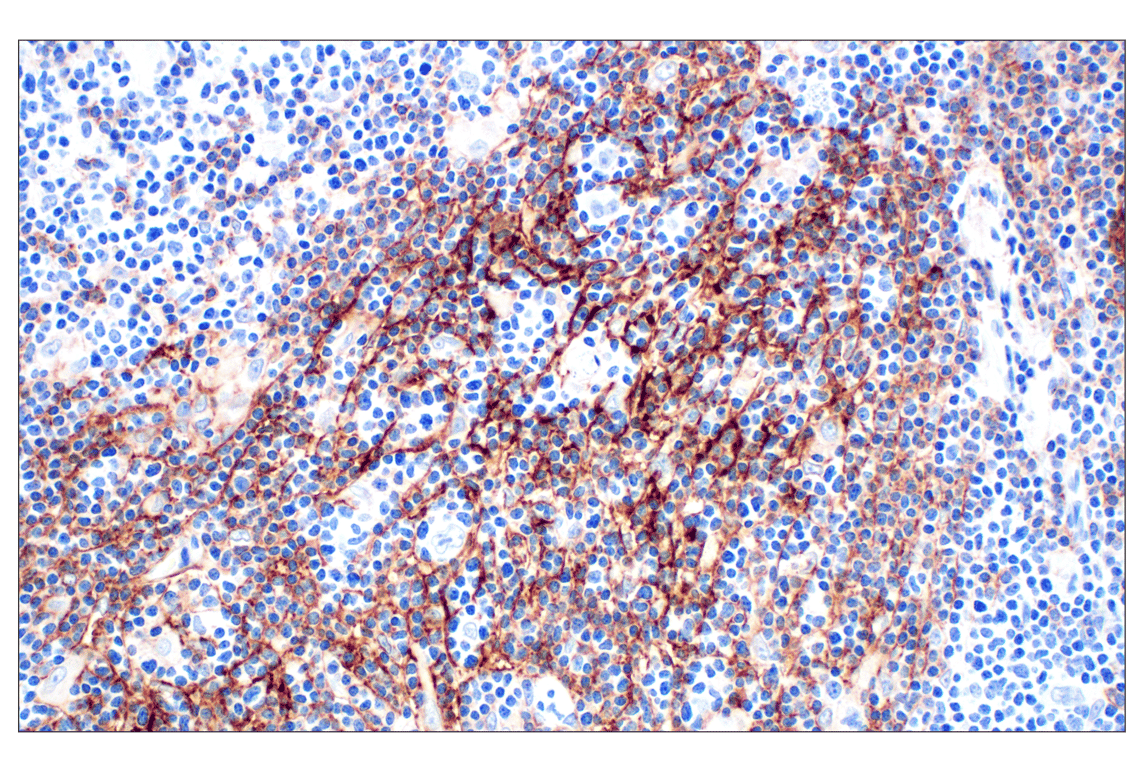 Immunohistochemistry Image 1: CR1/CD35 (E8B1Z) Rabbit Monoclonal Antibody