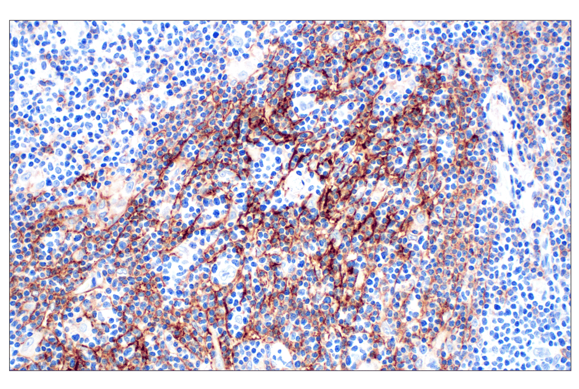 Immunohistochemistry Image 1: CR1/CD35 (E8B1Z) Rabbit mAb