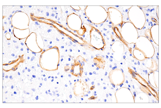 undefined Image 52: Pericyte Antibody Sampler Kit