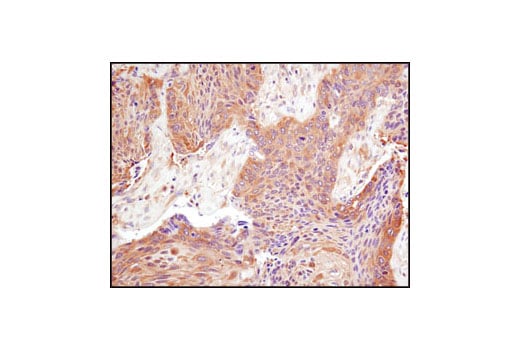 Immunohistochemistry Image 2: PKM2 (D78A4) Rabbit Monoclonal Antibody (BSA and Azide Free)