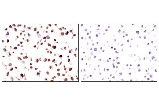 Immunohistochemistry Image 4: UTX (D3Q1I) Rabbit Monoclonal Antibody