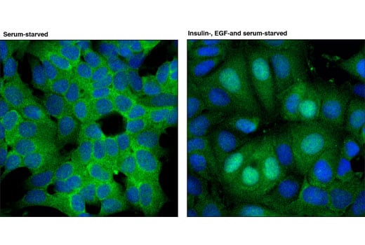 Immunofluorescence Image 2: RSK2 (D21B2) Rabbit Monoclonal Antibody (BSA and Azide Free)