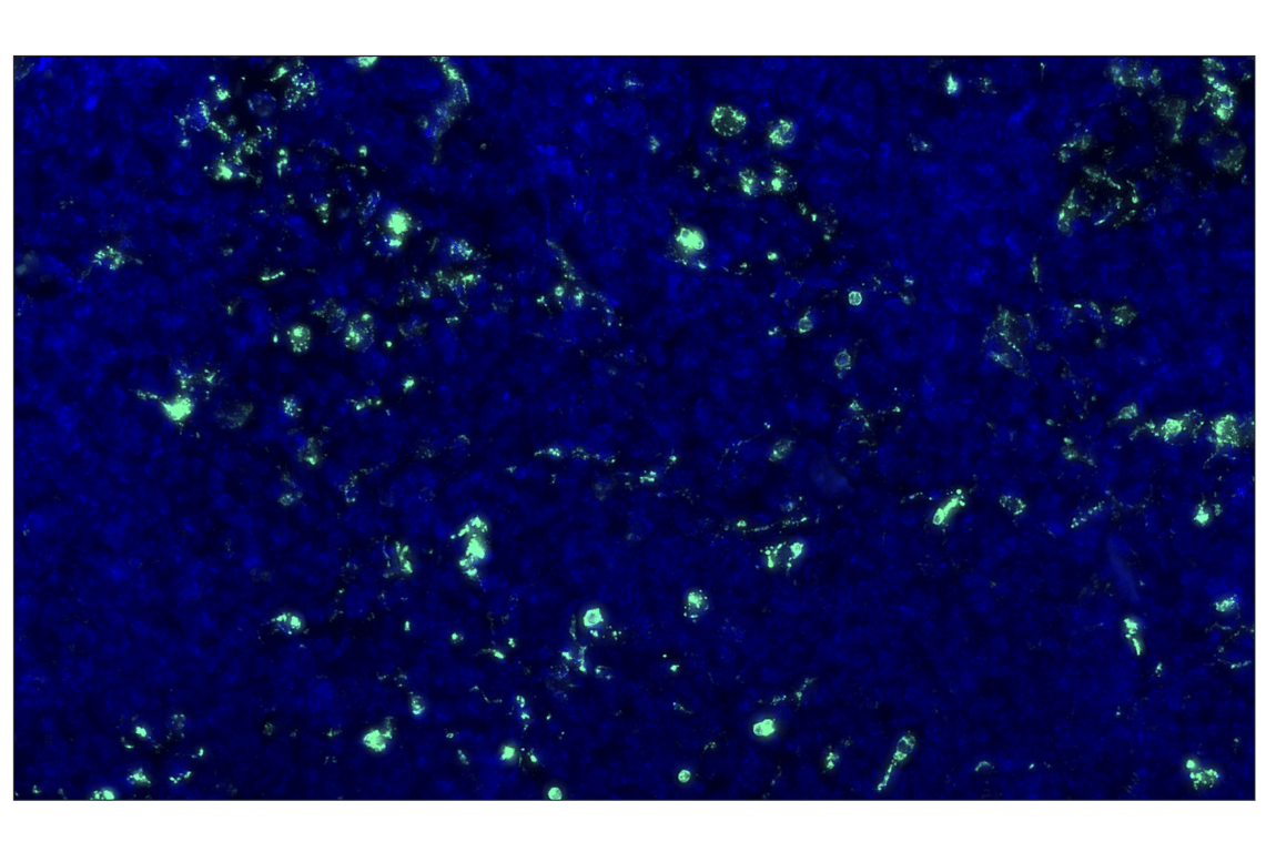 Immunohistochemistry Image 2: CD68 (E3O7V) Rabbit Monoclonal Antibody (Alexa Fluor<sup>®</sup> 488 Conjugate)