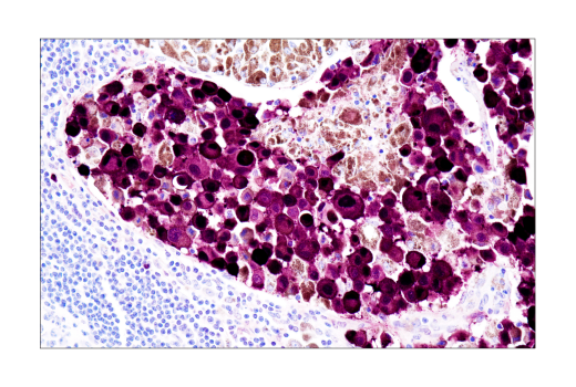 Immunohistochemistry Image 3: S100A1 (4C4.9) Mouse Monoclonal Antibody