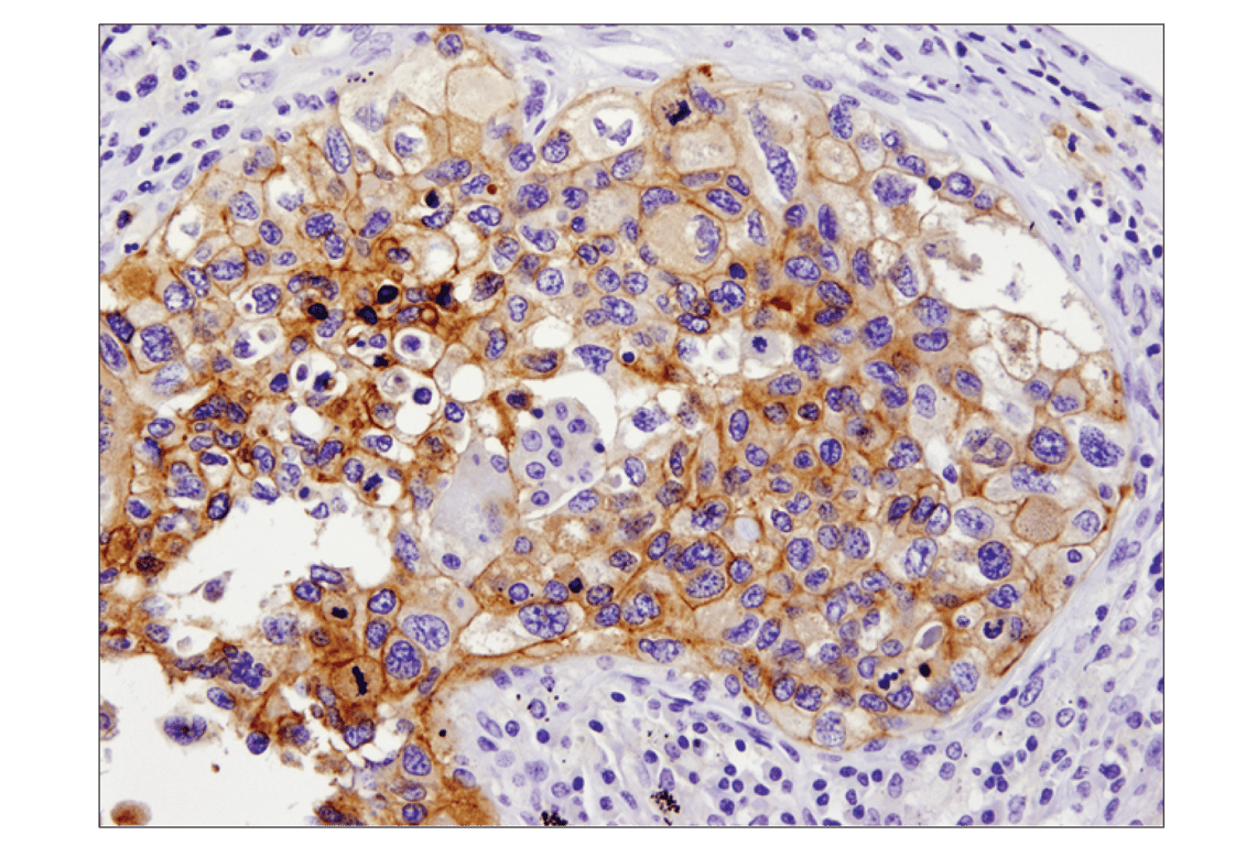 Immunohistochemistry Image 1: PD-L1 (E1L3N) Rabbit Monoclonal Antibody