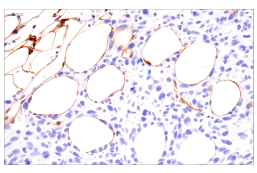 Immunohistochemistry Image 6: CD36 (E8B7S) Rabbit Monoclonal Antibody