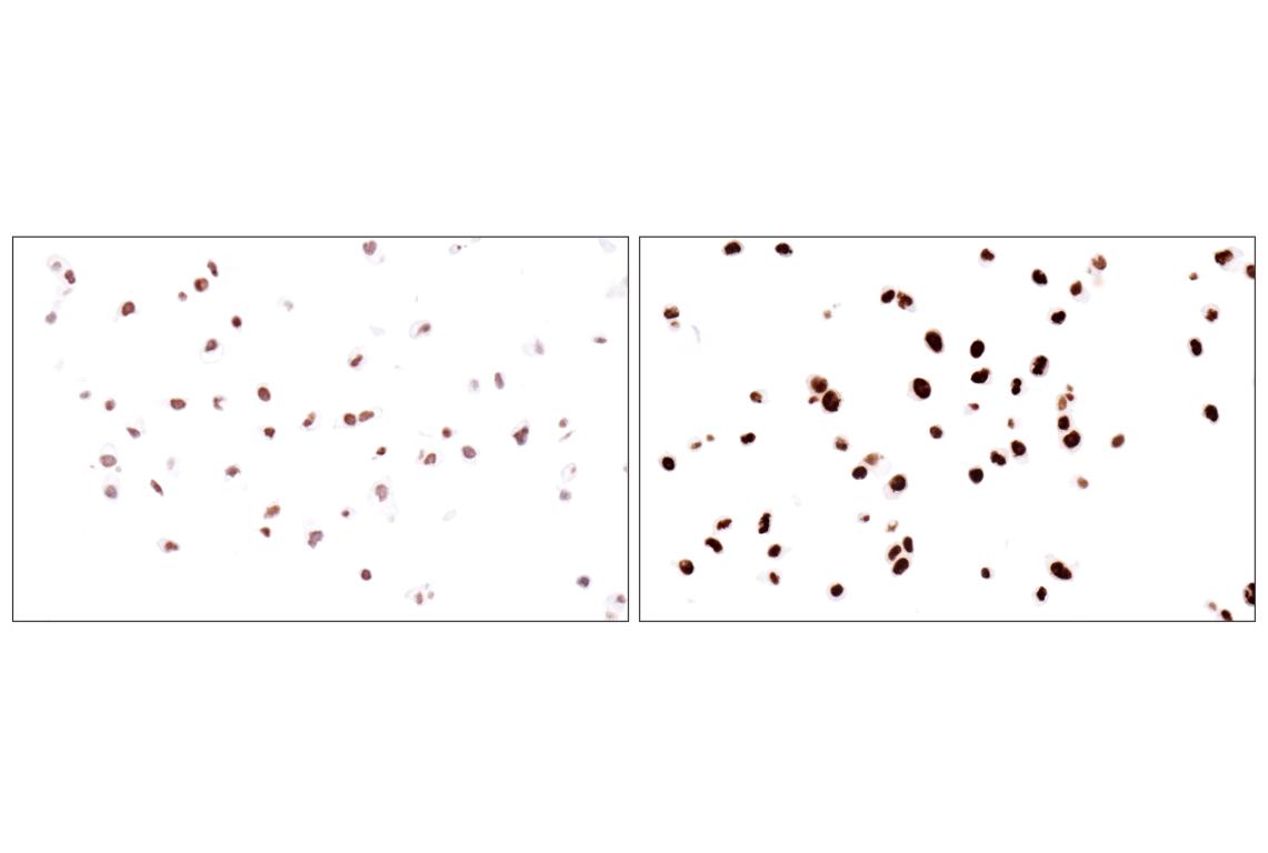 Immunohistochemistry Image 14: Acetyl-Histone H4 (Lys16) (E2B8W) Rabbit Monoclonal Antibody