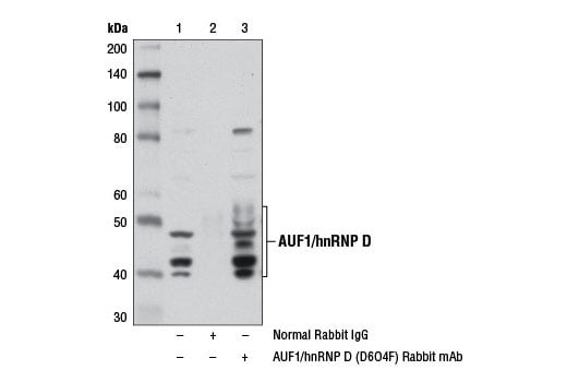 Immunoprecipitation Image 1: AUF1/hnRNP D (D6O4F) Rabbit Monoclonal Antibody
