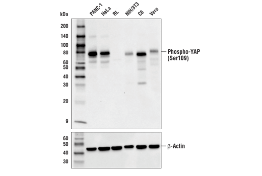 undefined Image 6: PhosphoPlus<sup>®</sup> YAP (Ser109) Antibody Duet