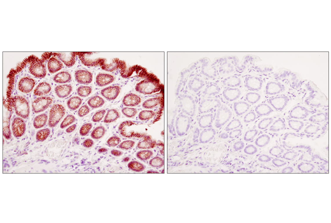 Immunohistochemistry Image 4: beta-Catenin (D10A8) Rabbit Monoclonal Antibody (BSA and Azide Free)