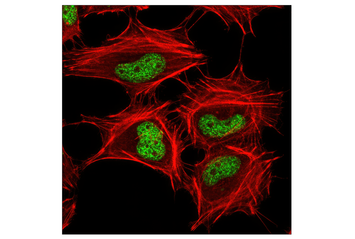 Immunofluorescence Image 1: Tri-Methyl-Histone H3 (Lys27) (C36B11) Rabbit mAb