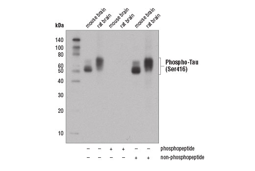 Western Blotting Image 3: Phospho-Tau (Ser416) (D7U2P) Rabbit Monoclonal Antibody