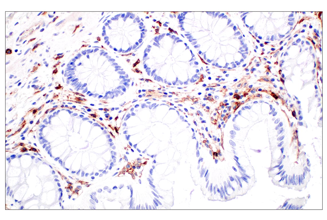 Immunohistochemistry Image 14: CD11b/ITGAM (E3J2F) Rabbit Monoclonal Antibody