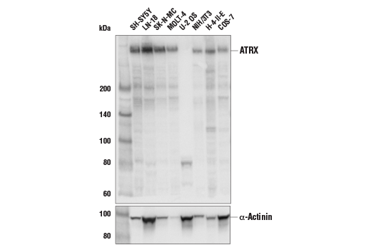 Western Blotting Image 1: ATRX (E5X7O) Rabbit mAb