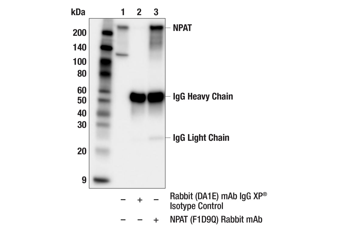 Immunoprecipitation Image 1: NPAT (F1D9Q) Rabbit Monoclonal Antibody