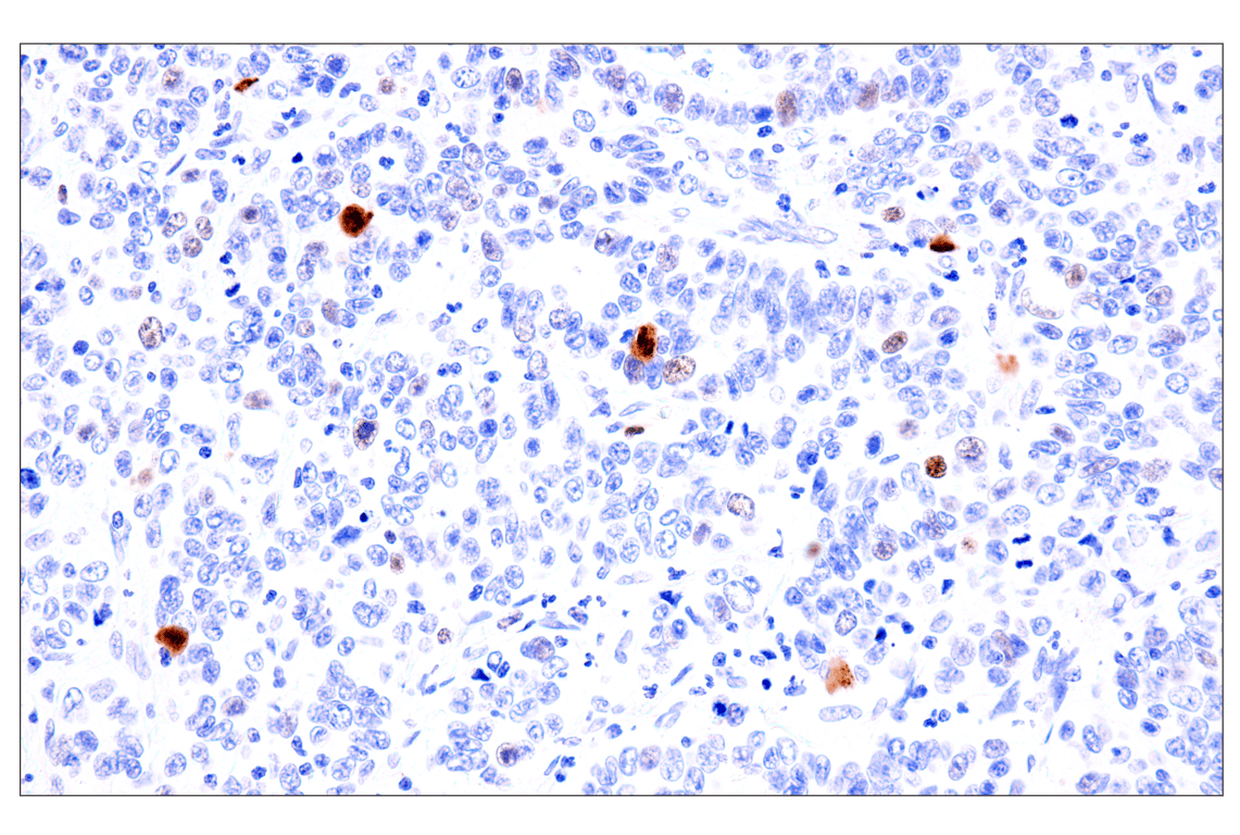 Immunohistochemistry Image 3: Phospho-NPM1 (Thr199) (E4C7S) Rabbit Monoclonal Antibody