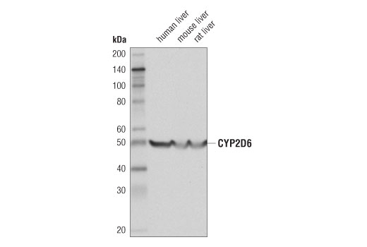 Western Blotting Image 1: CYP2D6 (D5A6X) Rabbit mAb