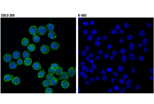 Immunofluorescence Image 1: EphB2 (D2X2I) Rabbit Monoclonal Antibody