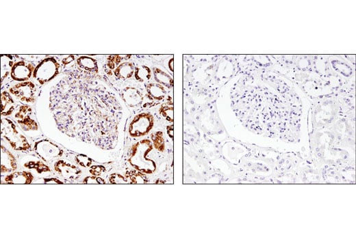 Immunohistochemistry Image 3: SOD2 (D3X8F) Rabbit Monoclonal Antibody