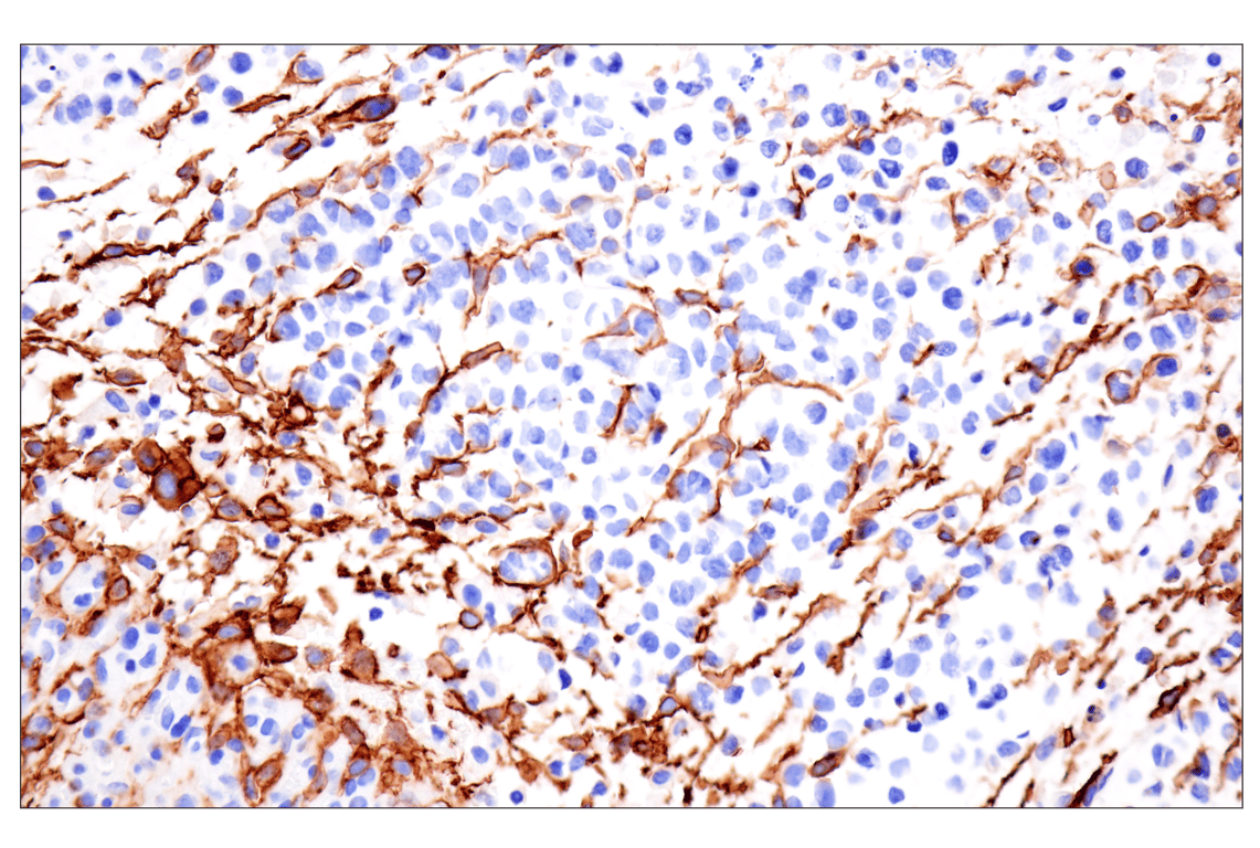 Immunohistochemistry Image 7: LRRC15 (E4X8J) Rabbit Monoclonal Antibody