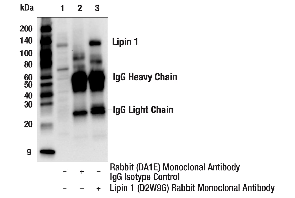 Immunoprecipitation Image 1: Lipin 1 (D2W9G) Rabbit Monoclonal Antibody