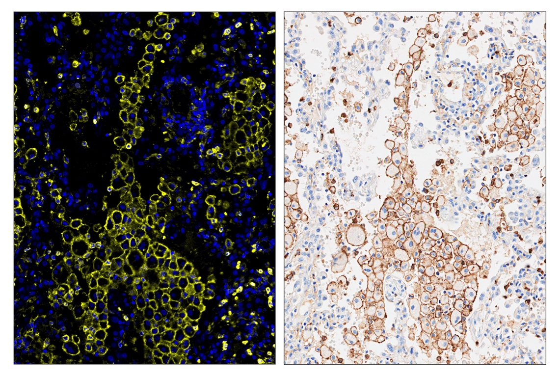 Immunohistochemistry Image 6: CD11b/ITGAM (D6X1N) & CO-0037-488 SignalStar<sup>™</sup> Oligo-Antibody Pair