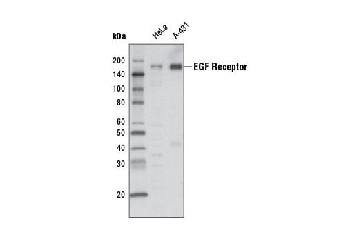 Western Blotting Image 1: EGF Receptor (D38B1) XP<sup>®</sup> Rabbit mAb (HRP Conjugate)