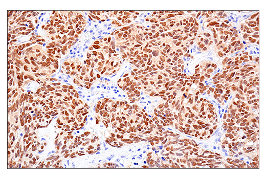 Immunohistochemistry Image 6: MAGE-A10 (E9V2Q) Rabbit Monoclonal Antibody