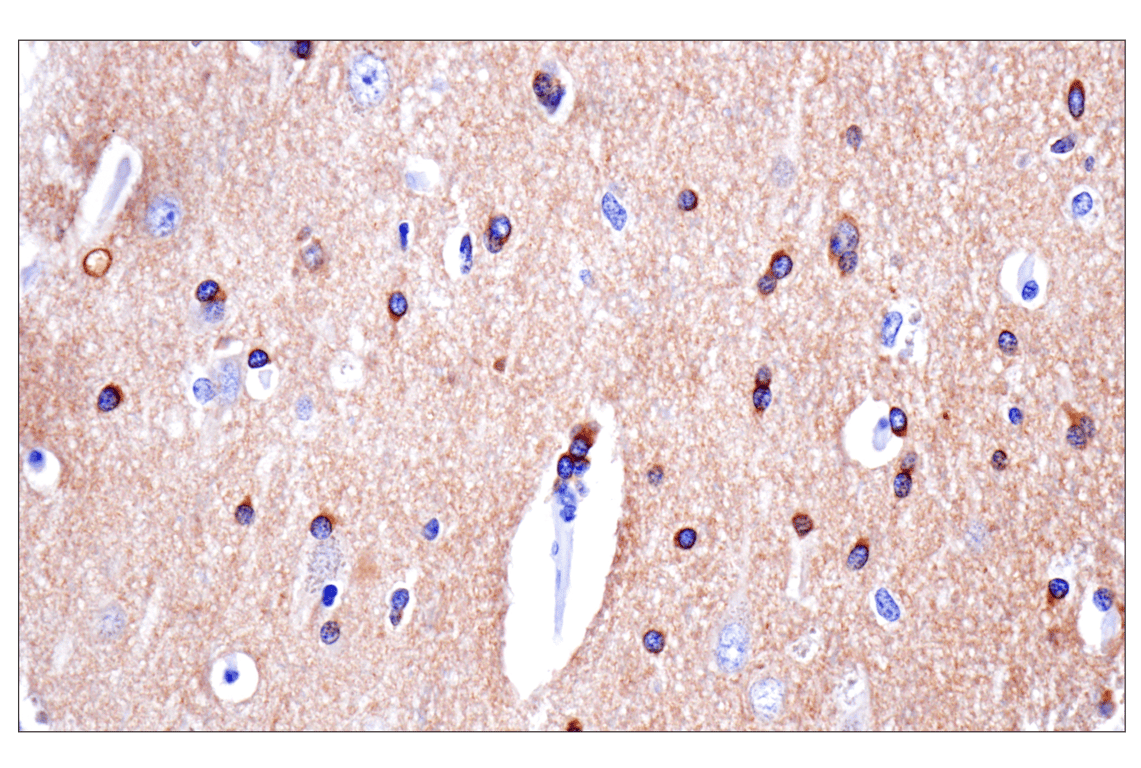 Immunohistochemistry Image 7: Phospho-Tau (Ser396) (F3S9T) Rabbit Monoclonal Antibody