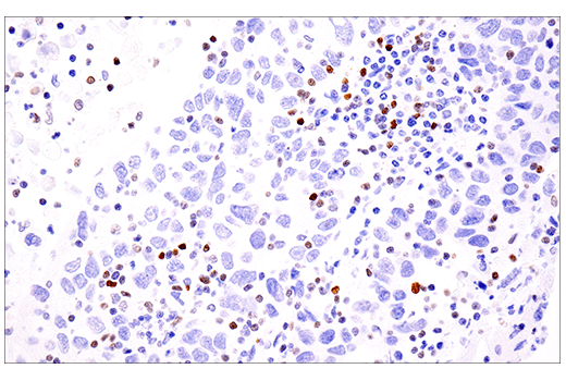 Immunohistochemistry Image 5: SATB1 (E5Z3U) Rabbit Monoclonal Antibody