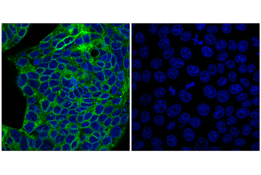 Immunofluorescence Image 1: GUCY2C (E1Q6S) Rabbit Monoclonal Antibody
