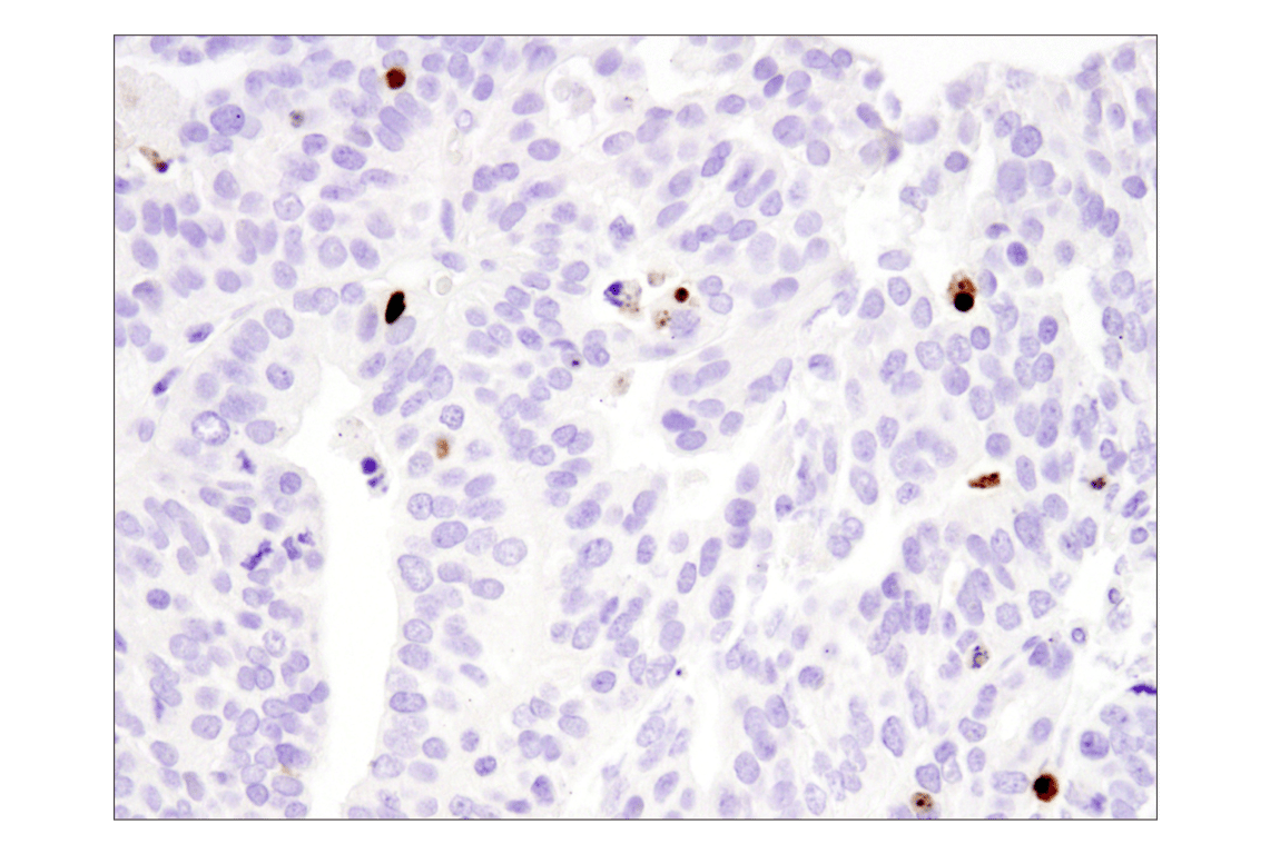 undefined Image 22: Apoptosis Antibody Sampler Kit II