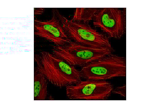 Immunofluorescence Image 1: MCM2 (D7G11) Rabbit Monoclonal Antibody (BSA and Azide Free)