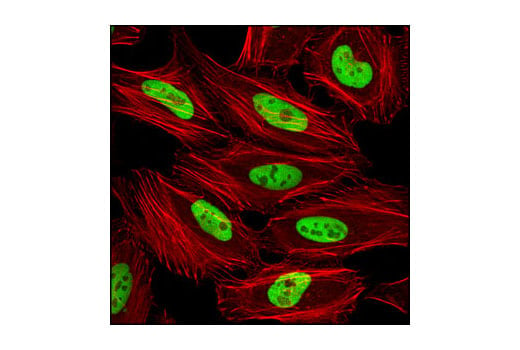 Immunofluorescence Image 1: MCM2 (D7G11) XP<sup>®</sup> Rabbit mAb (BSA and Azide Free)