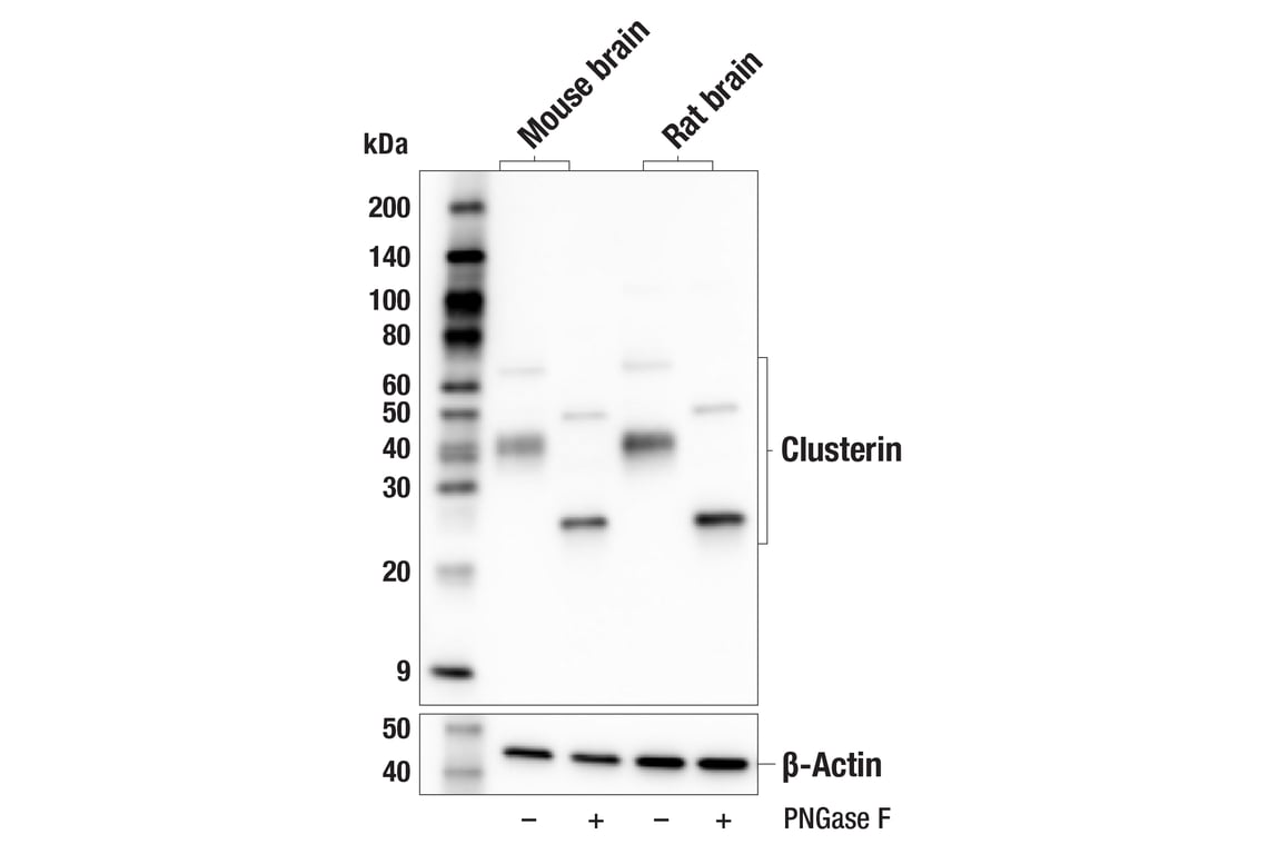 Western Blotting Image 2: Clusterin (E2O1D) Rabbit Monoclonal Antibody