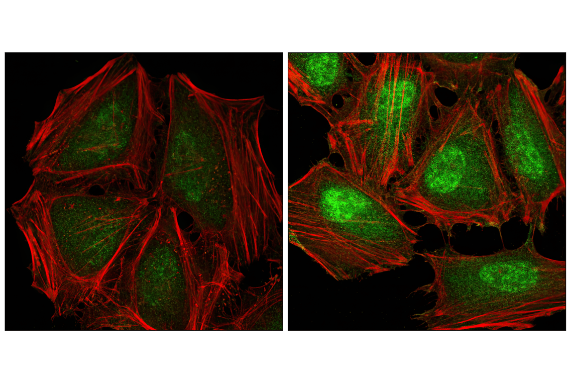 Immunofluorescence Image 1: Phospho-p38 MAPK (Thr180/Tyr182) (28B10) Mouse Monoclonal Antibody