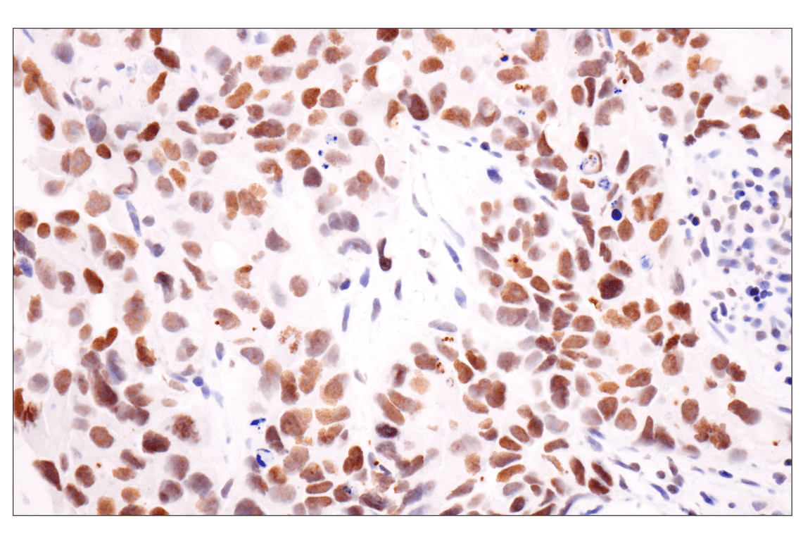 Immunohistochemistry Image 1: Acetyl-Histone H4 (Lys16) (E2B8W) Rabbit Monoclonal Antibody