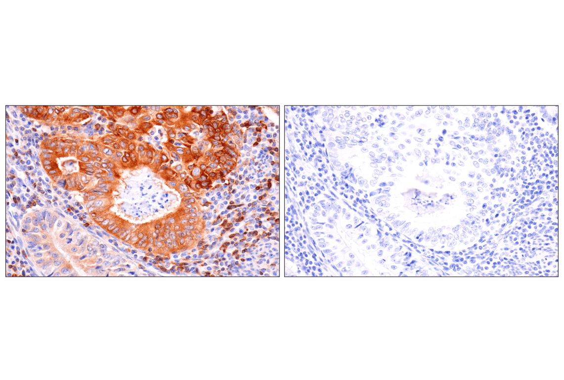 Immunohistochemistry Image 14: SPAK (F7T1K) Rabbit Monoclonal Antibody