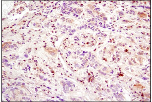undefined Image 26: Angiogenesis Antibody Sampler Kit